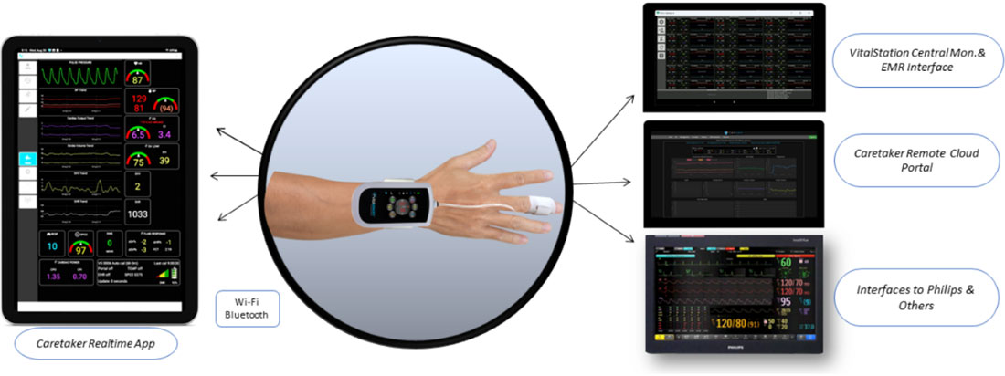 Vitalstream interface displays.